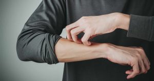 乾燥肌のかゆみに！かゆみの原因とおすすめのボディクリームを解説