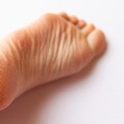 かかとがガサガサになる原因って？おすすめのかかと角質ケアグッズ